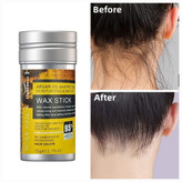 وز گیر مو استیکی لایتنس