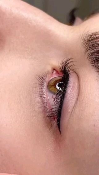 خط چشم کوزهای گابرینی